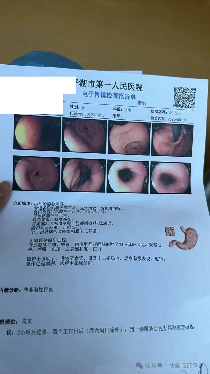 四年C2型萎缩性胃炎伴糜烂中医逆转案｜许盼盼医生20副中药化解瘀毒交阻